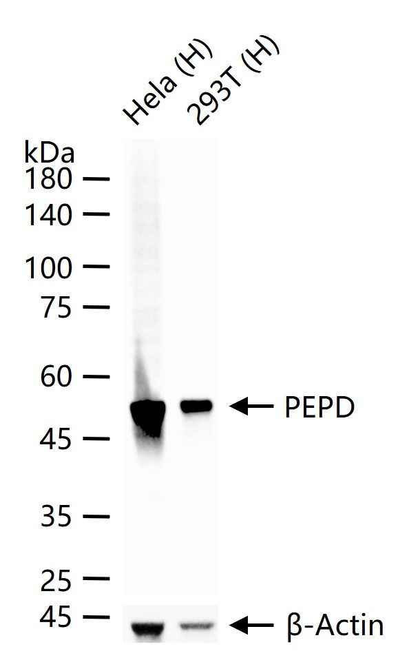 PEPD Antibody in Western Blot (WB)