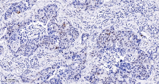 Phospho-PBK (Thr9) Antibody in Immunohistochemistry (Paraffin) (IHC (P))
