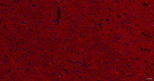 HOMER1 Antibody in Immunohistochemistry (Paraffin) (IHC (P))