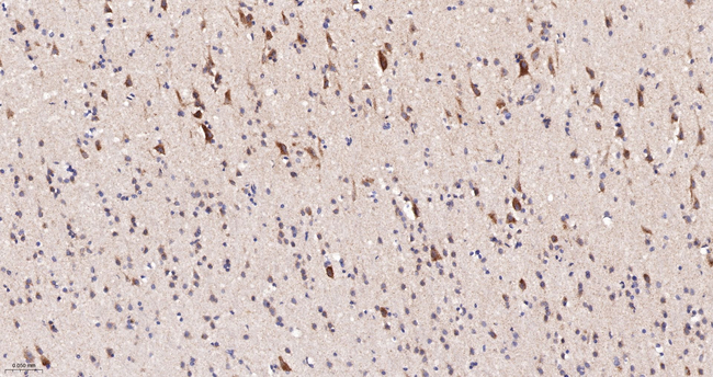 NDUFS2 Antibody in Immunohistochemistry (Paraffin) (IHC (P))