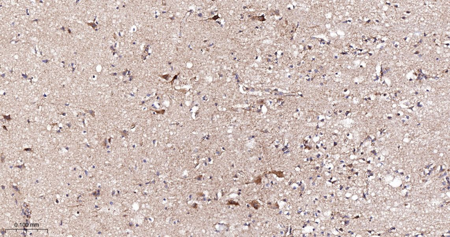 NDUFC2 Antibody in Immunohistochemistry (Paraffin) (IHC (P))