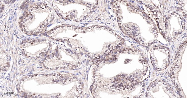 CRCP Antibody in Immunohistochemistry (Paraffin) (IHC (P))