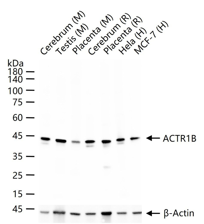 ACTR1B Antibody in Western Blot (WB)