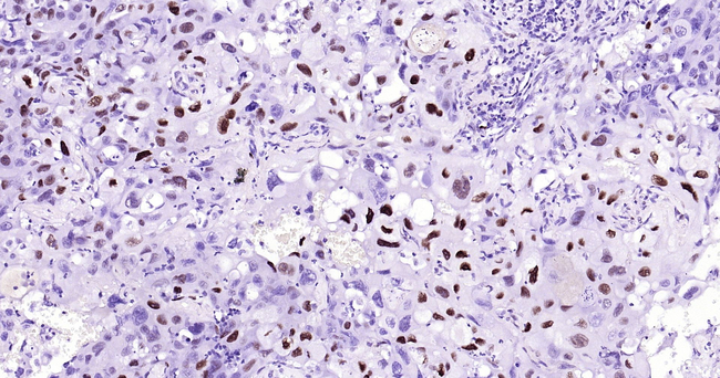 Phospho-c-Jun (Thr91, Thr93) Antibody in Immunohistochemistry (Paraffin) (IHC (P))