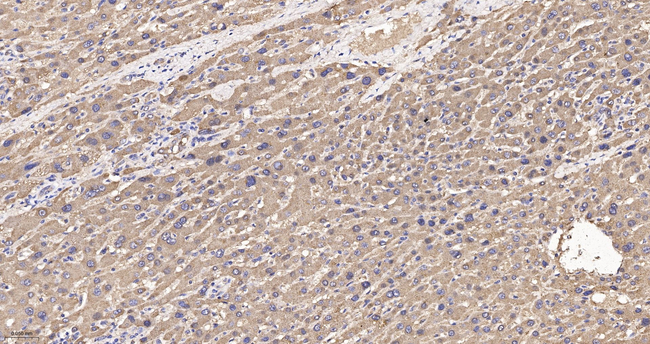 ATE1 Antibody in Immunohistochemistry (Paraffin) (IHC (P))