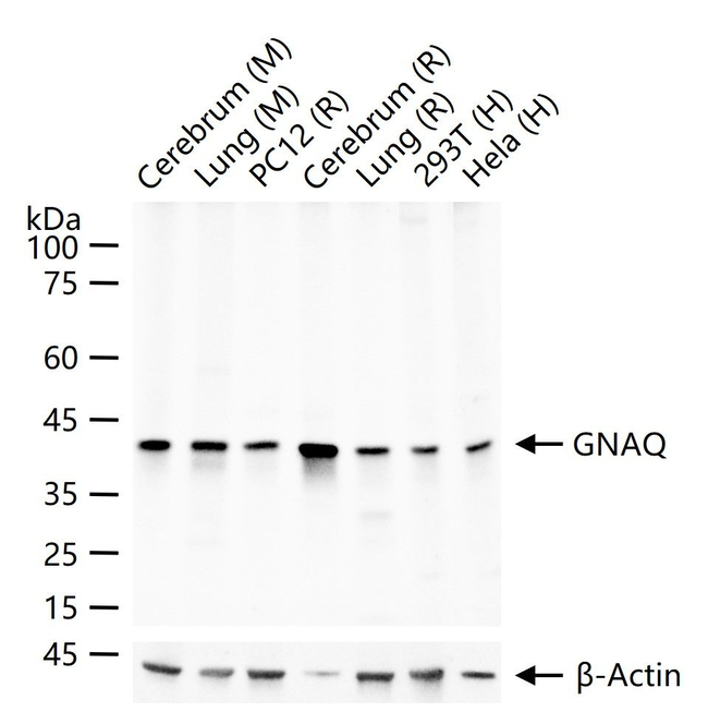 GNAQ Antibody in Western Blot (WB)
