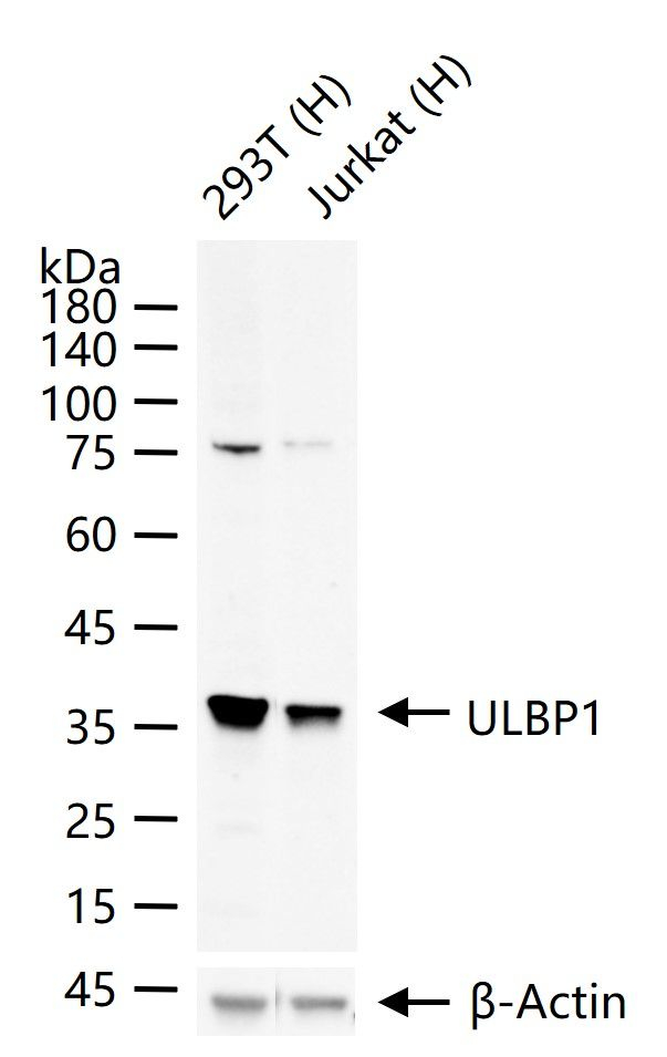 ULBP1 Antibody in Western Blot (WB)