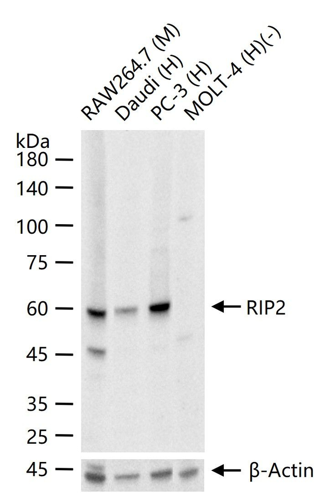 RIP2 Antibody in Western Blot (WB)