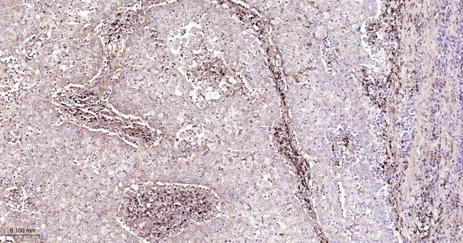 IKK beta Antibody in Immunohistochemistry (Paraffin) (IHC (P))