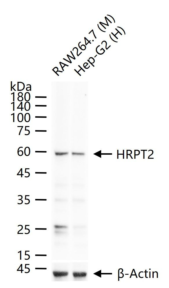 Cdc73 Antibody in Western Blot (WB)