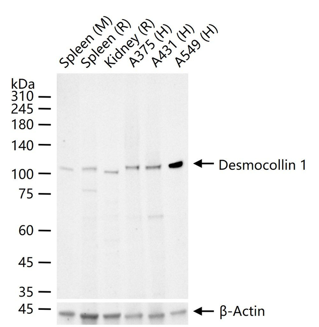 DSC1 Antibody in Western Blot (WB)