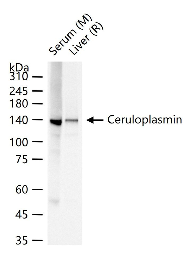 Ceruloplasmin Antibody in Western Blot (WB)