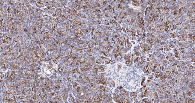 IQGAP2 Antibody in Immunohistochemistry (Paraffin) (IHC (P))