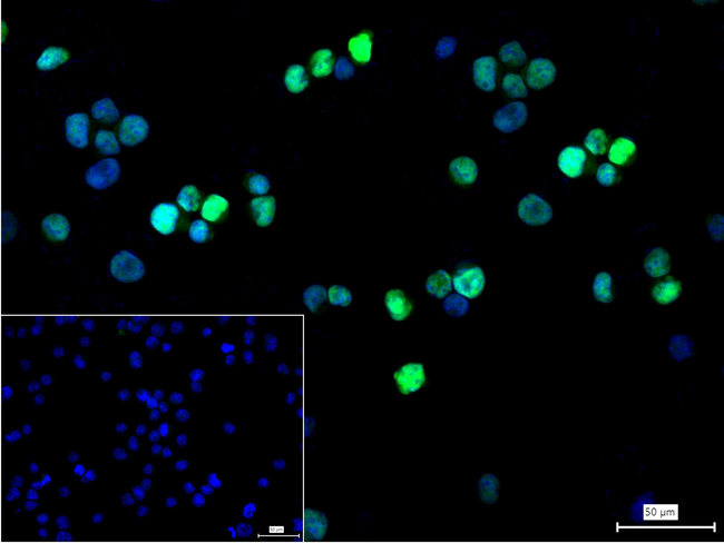 IRF4 Antibody in Immunocytochemistry (ICC/IF)
