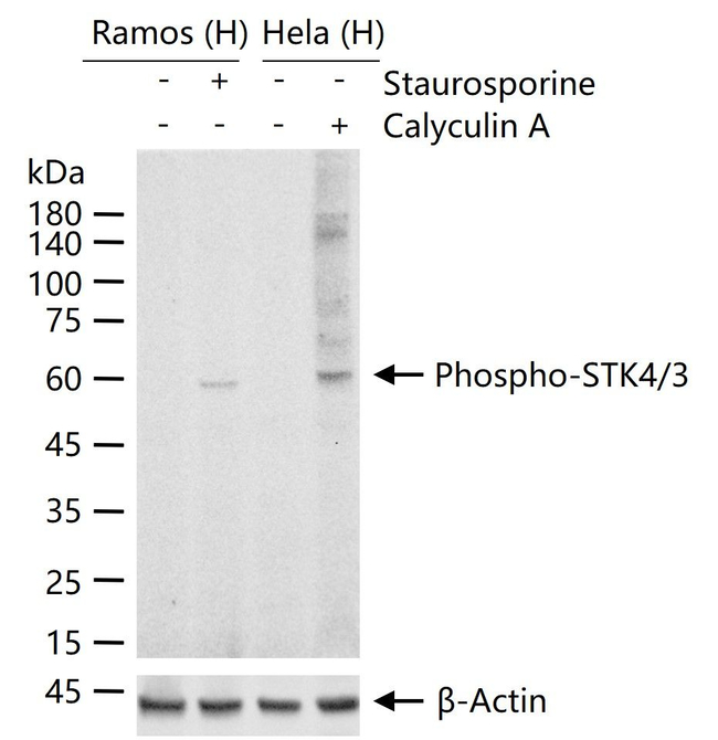 Phospho-MST1/MST2 (Thr183, Thr180) Antibody in Western Blot (WB)