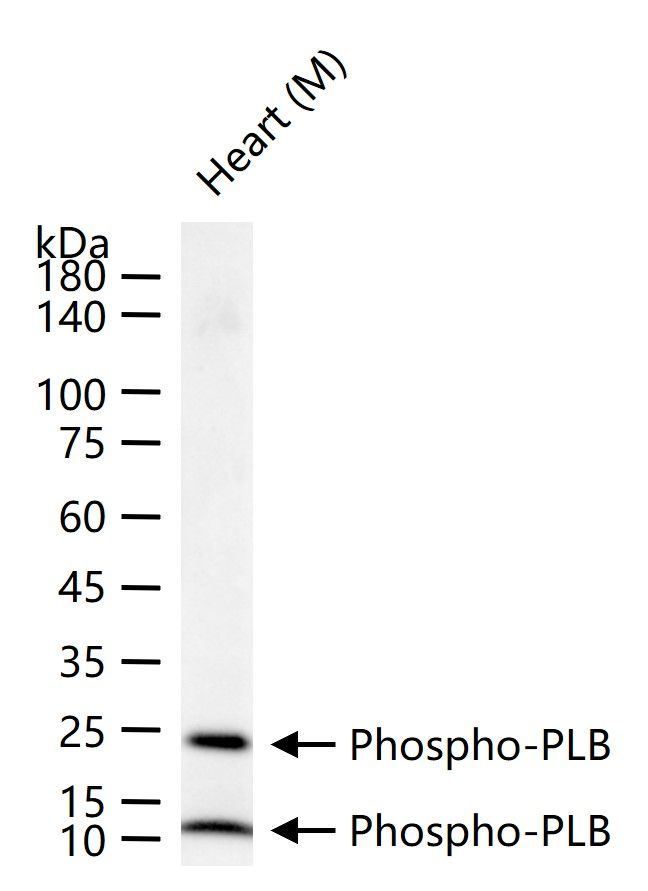 Phospho-Phospholamban (Ser16) Antibody in Western Blot (WB)