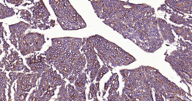 CD51 Antibody in Immunohistochemistry (Paraffin) (IHC (P))
