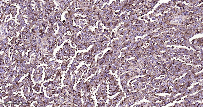 SYPL1 Antibody in Immunohistochemistry (Paraffin) (IHC (P))