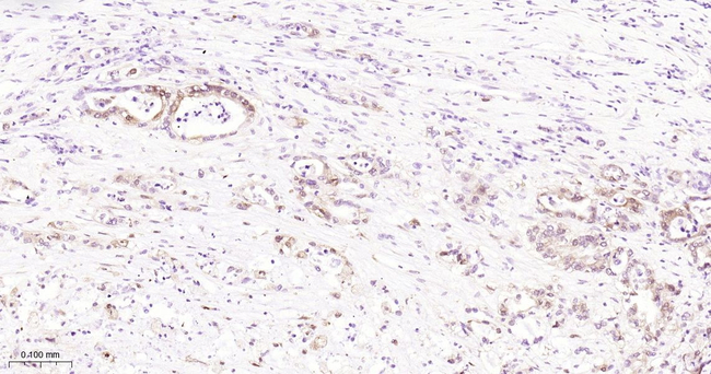 Phospho-4EBP1/2/3 (Thr46, Thr46, Thr32) Antibody in Immunohistochemistry (Paraffin) (IHC (P))