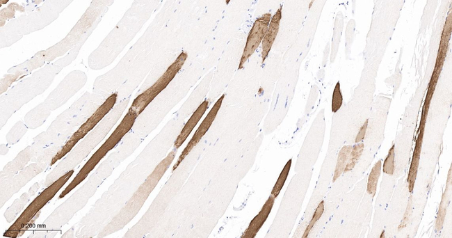 MYH2 Antibody in Immunohistochemistry (Paraffin) (IHC (P))