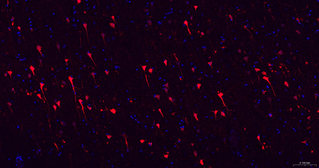 Phospho-MAP2 (Ser136) Antibody in Immunohistochemistry (Paraffin) (IHC (P))