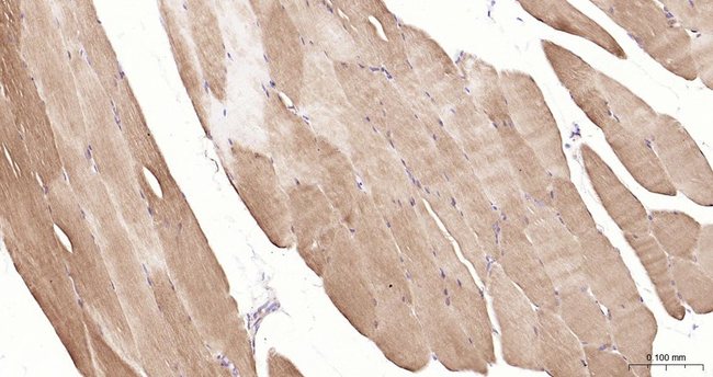 LDHA Antibody in Immunohistochemistry (Paraffin) (IHC (P))