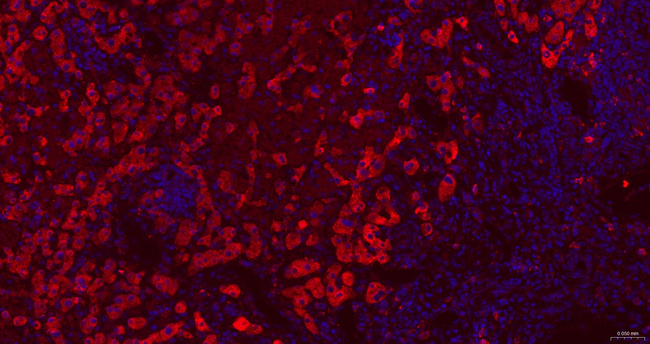 ERp72 Antibody in Immunohistochemistry (Paraffin) (IHC (P))