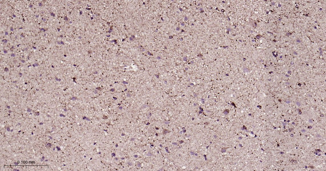 LRRK2 Antibody in Immunohistochemistry (Paraffin) (IHC (P))