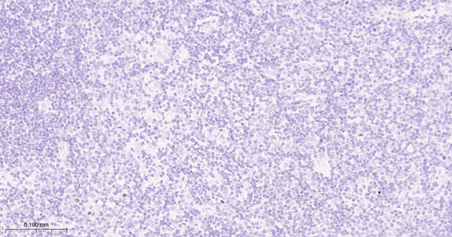 c-MAF Antibody in Immunohistochemistry (Paraffin) (IHC (P))