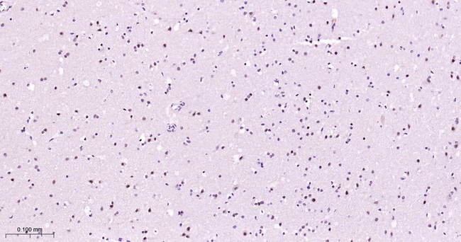 Phospho-MEK1 (Thr292) Antibody in Immunohistochemistry (Paraffin) (IHC (P))