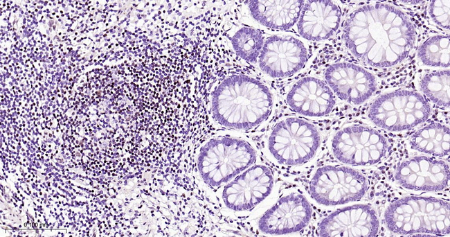 MEF2A/MEF2C Antibody in Immunohistochemistry (Paraffin) (IHC (P))