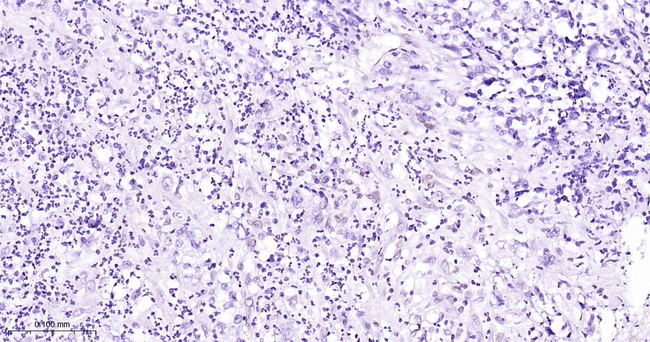 MEF2C Antibody in Immunohistochemistry (Paraffin) (IHC (P))