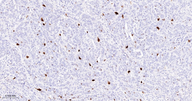 Phospho-Nucleolin (Thr84) Antibody in Immunohistochemistry (Paraffin) (IHC (P))