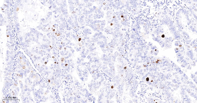 Phospho-Nucleolin (Thr76) Antibody in Immunohistochemistry (Paraffin) (IHC (P))