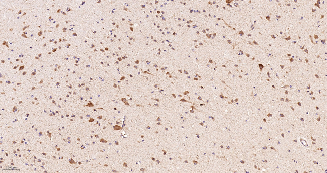 NDUFS4 Antibody in Immunohistochemistry (Paraffin) (IHC (P))