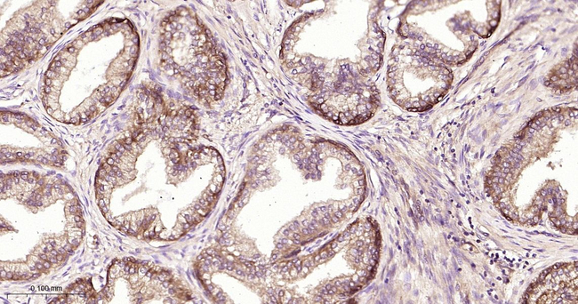 NME1/NME2 Antibody in Immunohistochemistry (Paraffin) (IHC (P))