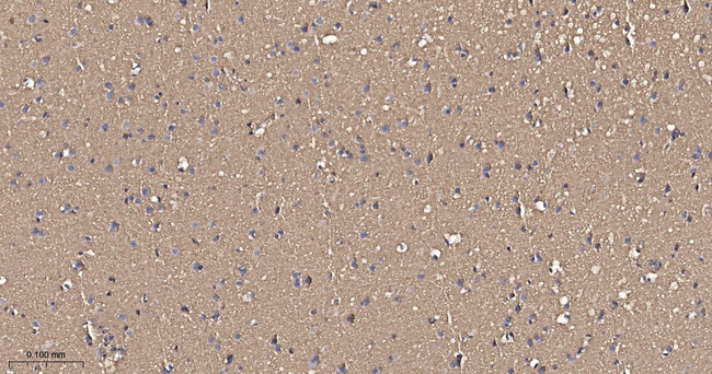 Pan Ras Antibody in Immunohistochemistry (Paraffin) (IHC (P))