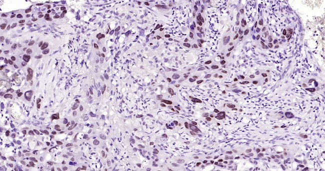 NUP50 Antibody in Immunohistochemistry (Paraffin) (IHC (P))