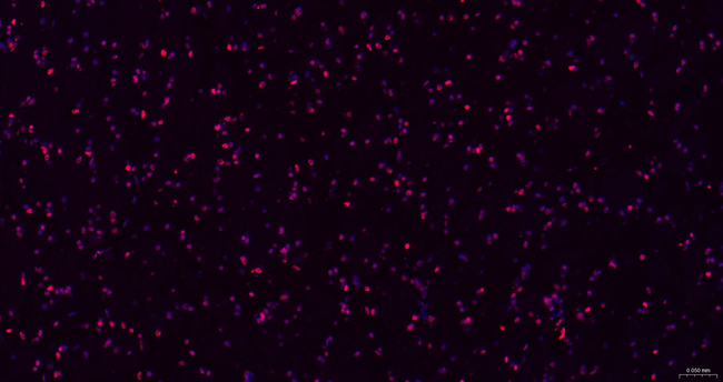 OTX1/2 Antibody in Immunohistochemistry (Paraffin) (IHC (P))