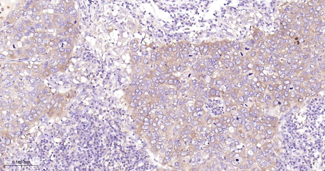 Phospho-PAK1/2/3 (Ser144, Ser141, Ser154) Antibody in Immunohistochemistry (Paraffin) (IHC (P))