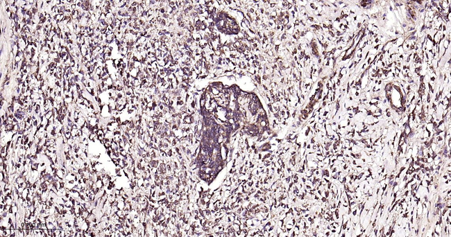 PAK1 Antibody in Immunohistochemistry (Paraffin) (IHC (P))