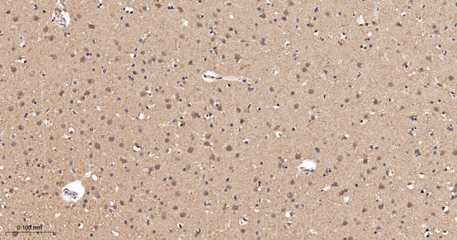 PLCB3 Antibody in Immunohistochemistry (Paraffin) (IHC (P))