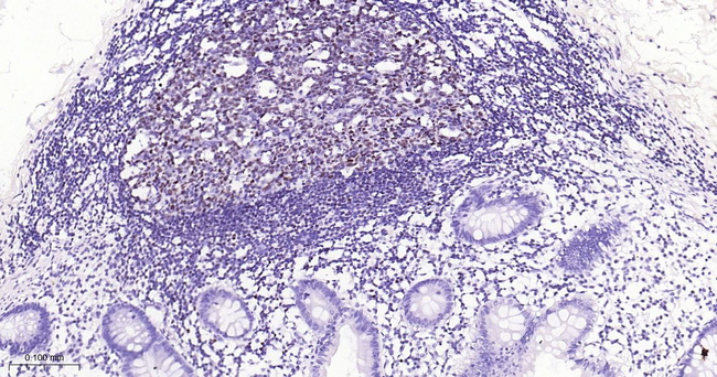 Oct-2 Antibody in Immunohistochemistry (Paraffin) (IHC (P))