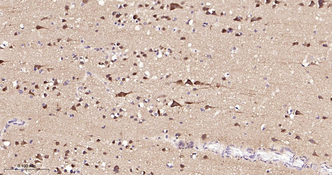 PREPL Antibody in Immunohistochemistry (Paraffin) (IHC (P))