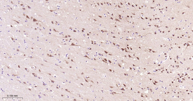 PREPL Antibody in Immunohistochemistry (Paraffin) (IHC (P))