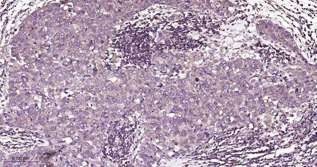 PKC Antibody in Immunohistochemistry (Paraffin) (IHC (P))