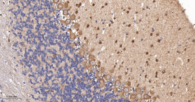 PKC delta/theta Antibody in Immunohistochemistry (Paraffin) (IHC (P))