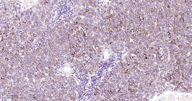 PKC Antibody in Immunohistochemistry (Paraffin) (IHC (P))