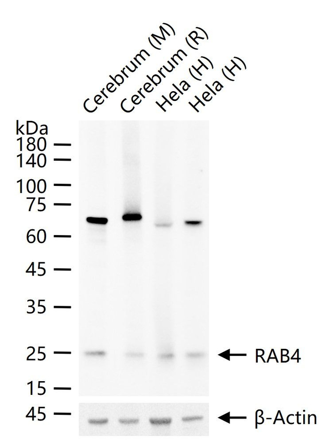 Rab4 Antibody in Western Blot (WB)
