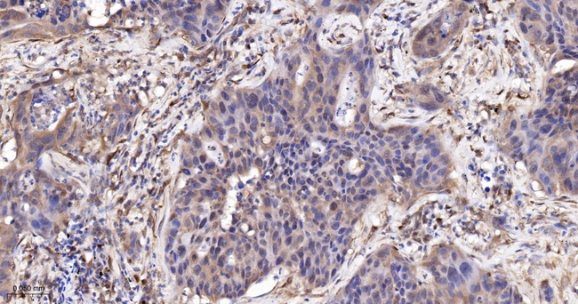 RelB Antibody in Immunohistochemistry (Paraffin) (IHC (P))